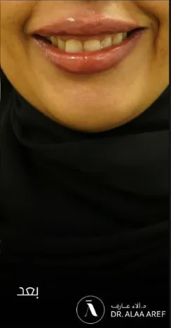 بعد