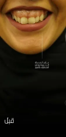 قبل