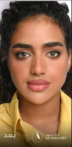 بعد