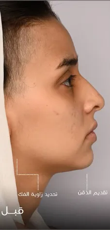 قبل