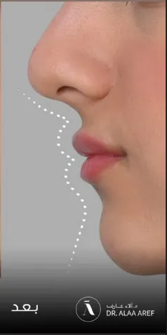بعد
