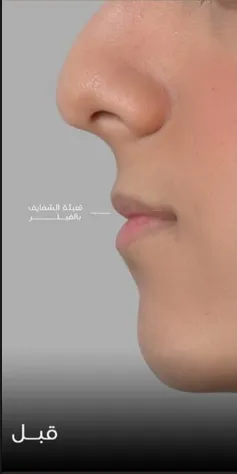 قبل